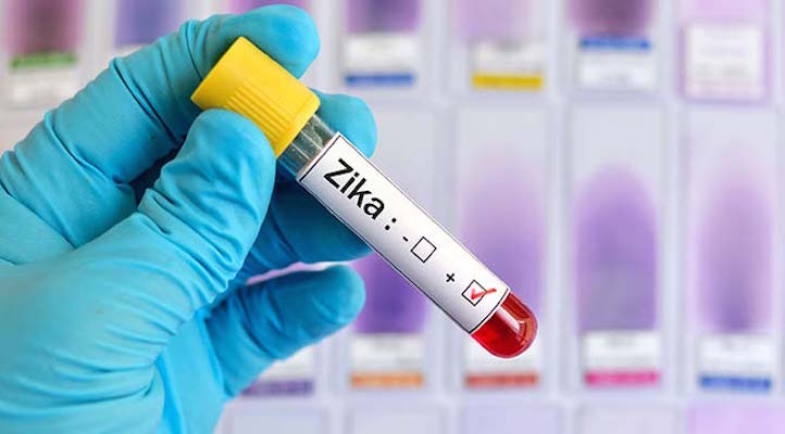 zika-virusu