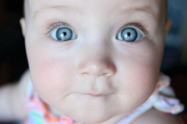 İri Gözlü Bebeklere Dikkat! Risk Altında Olabilirler
